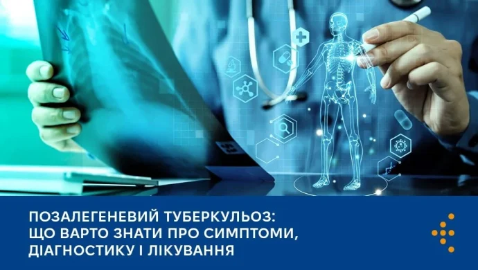 Позалегеневий туберкульоз: невидима загроза чи керована хвороба? Факти, симптоми й лікування в Україні