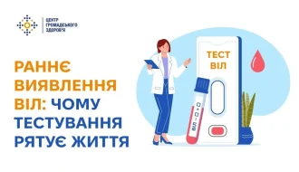 Тест на ВІЛ: коли не можна зволікати і що робити після результату?