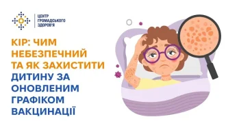 Кір у 2026 році: що мають знати батьки – 9 із 10 невакцинованих хворіють після контакту