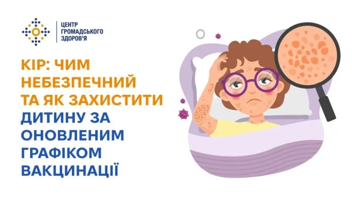 Кір у 2026: вірус тримається в повітрі до двох годин – вакцина КПК захищає дітей